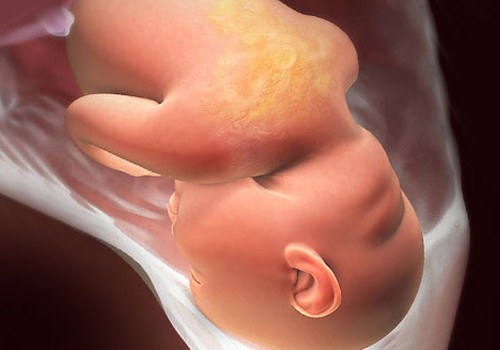 VIDEO Nėštumo kalendorius. 34 savaitė: kūdikio galva nusileidžia į apačią