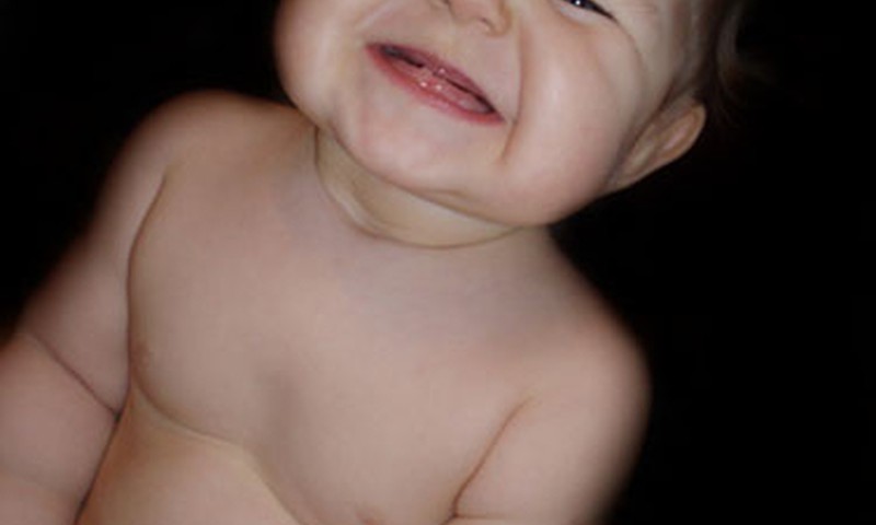 Lukas: mama, patepk kojos delną