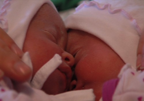 VIDEO: Dvynukų gimimas - unikalūs vaizdai