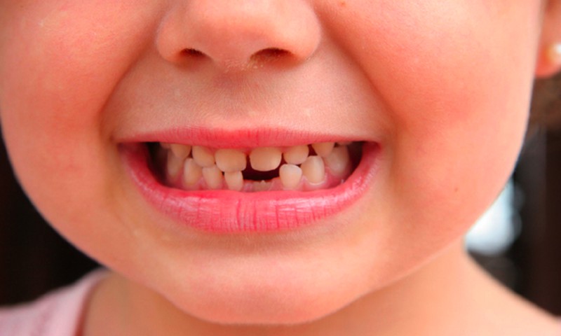 SAVAITGALIO KONKURSAS: Papasakok, kas ir kaip nusineša dantukus Tavo namuose