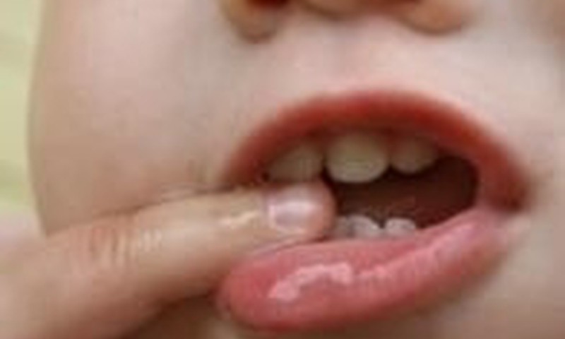 Kaip padėti vaikui dygstant dantukams?