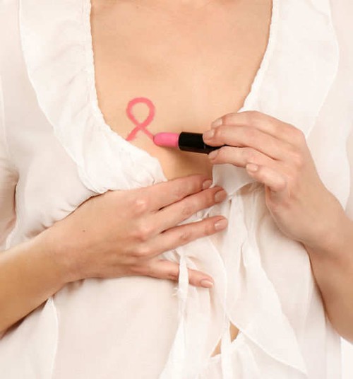 Krūties vėžio užkluptas moteris nuo chemoterapijos gelbsti genetinis molekulinis tyrimas