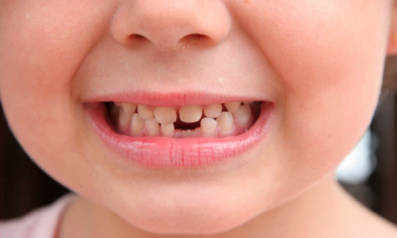 7 triukai, kurie padės vaiką motyvuoti valytis dantis