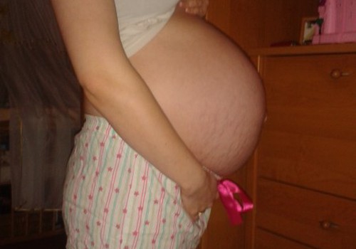 38 nėštumo savaitė: Leliukas jau pasiruošęs gimti