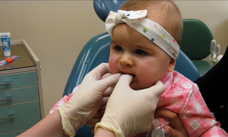 Kaip prižiūrite pačius pirmuosius vaikų dantukus?