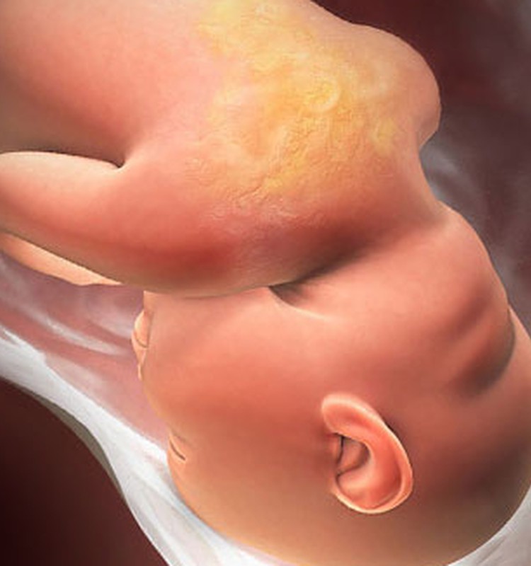 VIDEO Nėštumo kalendorius. 34 savaitė: kūdikio galva nusileidžia į apačią