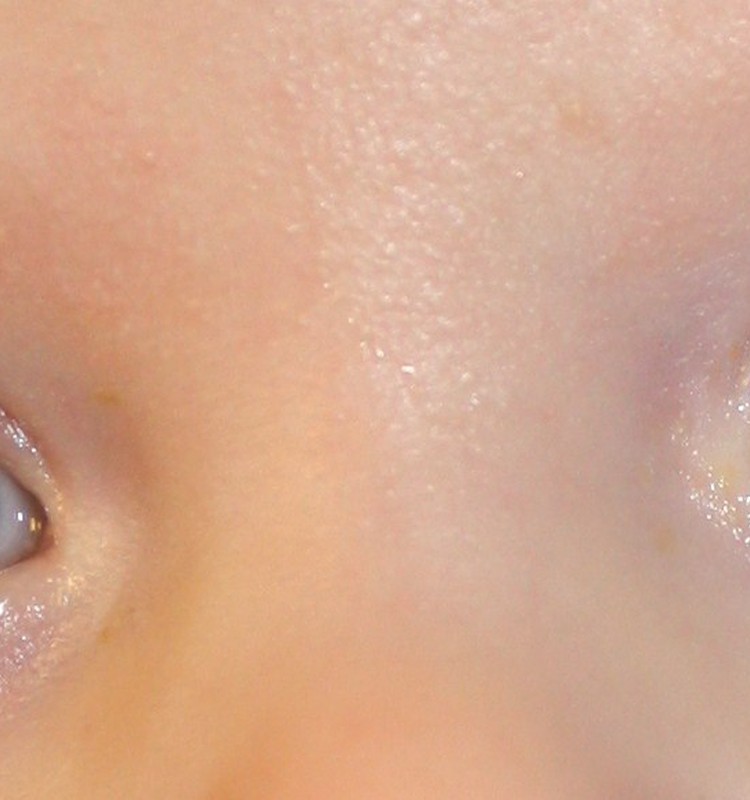 Kada vaikui būtina pirmą kartą patikrinti akytes? 