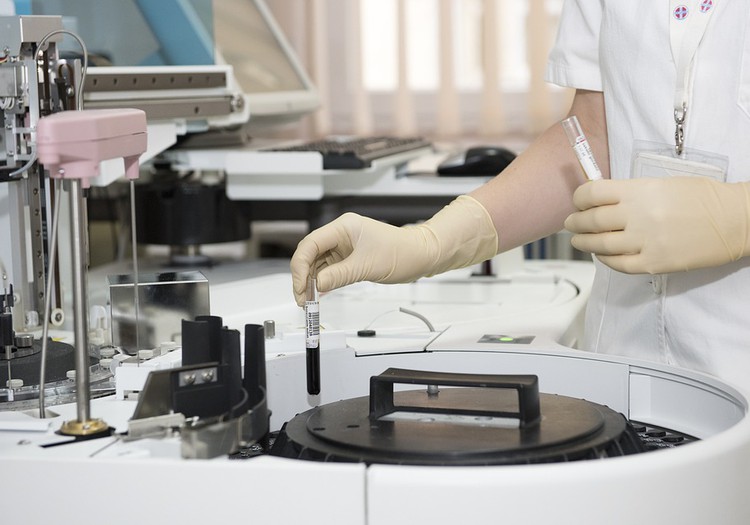Kalifornijos universiteto biologai atrado atsakymą, kodėl nepavyksta pastoti