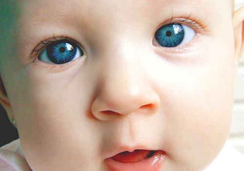 Kūdikių žvairumas - kada verta sunerimti?