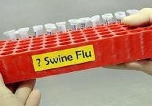 27 metų vyras – pirmoji kiaulių gripo auka Lietuvoje