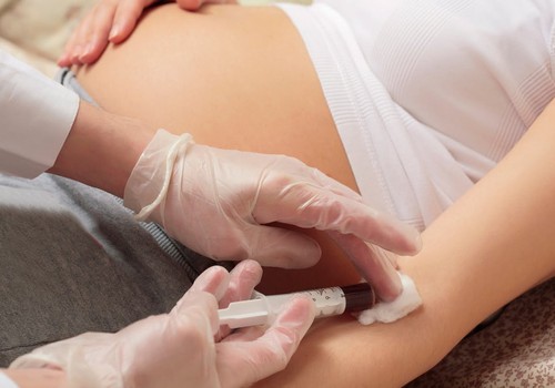 Kada nėštutei atlikti gliukozės testą?