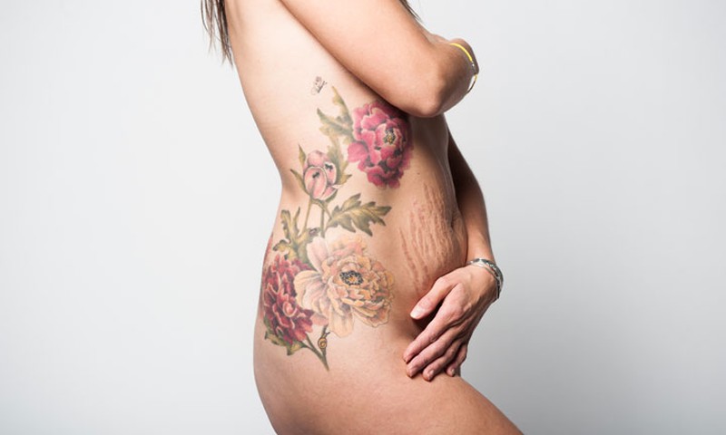 Lieknėju su MK - gražių mamų gražūs kūnai po gimdymo :)