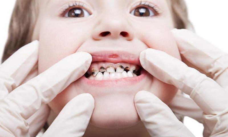 Juoduoja vaiko dantukas - ką daryti?