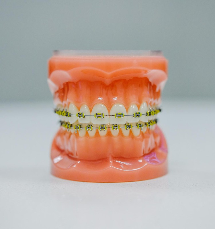 Pirmasis vaiko vizitas pas ortodontą: kada ir kodėl neatidėlioti?