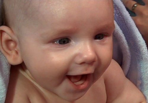 VIDEO: Kaip prižiūrėti kūdikio odelę, kad neatsirastų bėrimų