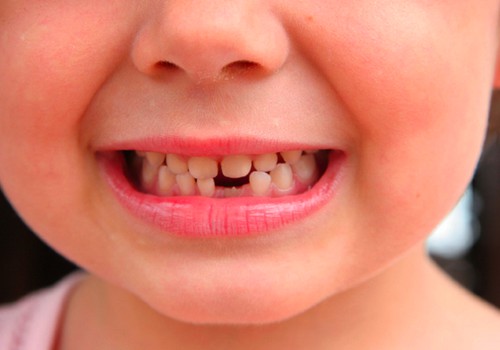 SAVAITGALIO KONKURSAS: Papasakok, kas ir kaip nusineša dantukus Tavo namuose