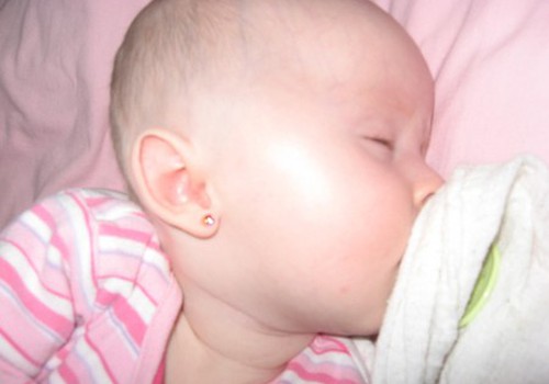8 mėnesių kūdikiui atlėpo ausytės