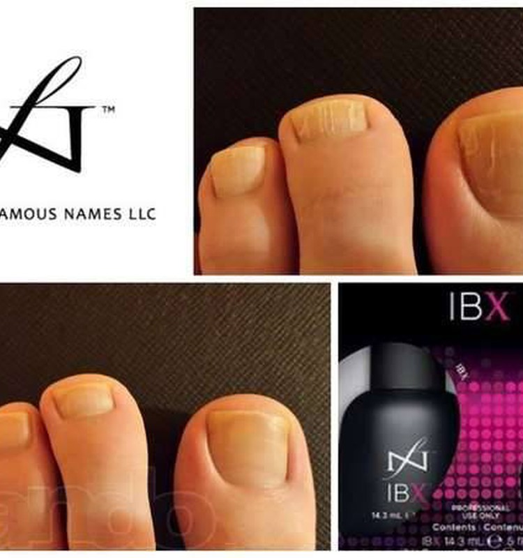 Naujiena! "IBX" sistema - nagų gydimas iš vidaus