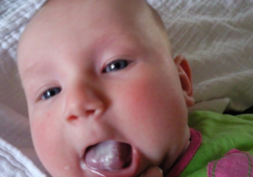 Ar reikia nuvalyti pieno likučius nuo kūdikio liežuvėlio?