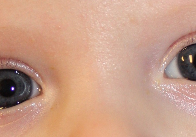 Kada vaikui būtina pirmą kartą patikrinti akytes? 