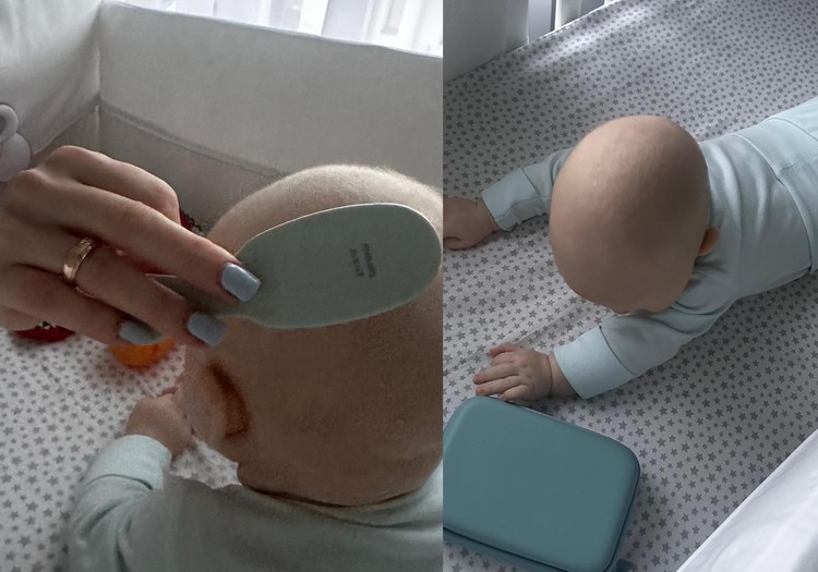 Naujagimio prieziuros rinkinio analize