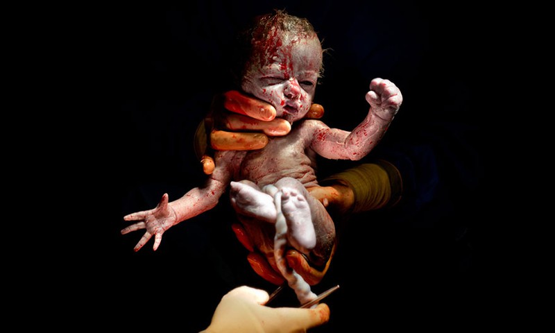 Kaip atrodo ką tik gimęs kūdikis? Įspūdingas nuotraukų albumas!