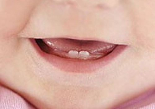  Kaip turėti sveikus dantis: pagrindinės taisyklės