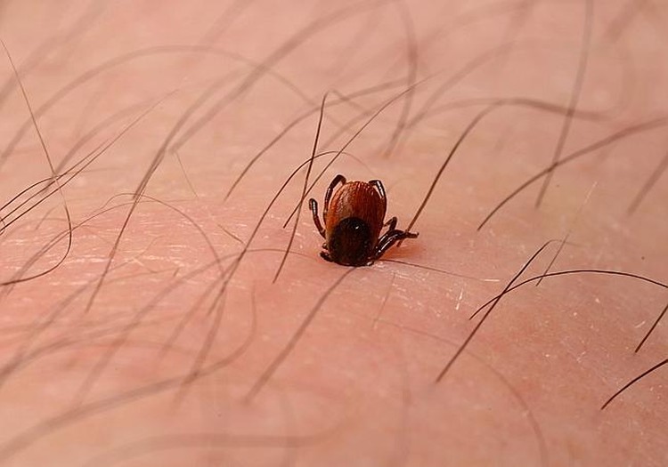 Kada jau galima skiepyti vaikus nuo erkinio encefalito?