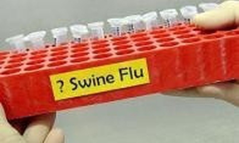 27 metų vyras – pirmoji kiaulių gripo auka Lietuvoje